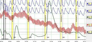 lie detection test polygraph